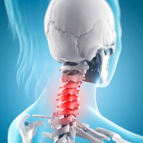 spine with red color on the neck indicating pain